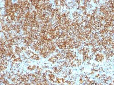Immunohistochemistry-Paraffin: CD45 Antibody (SPM569 + SPM570) - Azide and BSA Free [NBP2-34430]