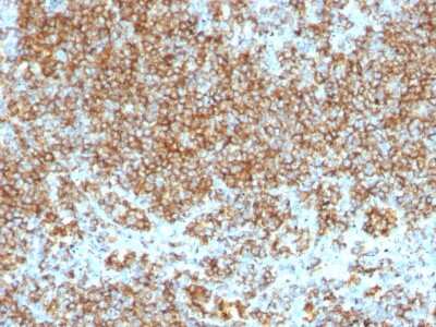 Immunohistochemistry-Paraffin: CD45 Antibody (SPM569 + SPM570) [NBP2-34383]