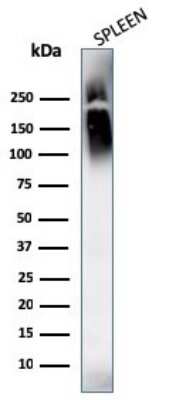 Western Blot: CD45 Antibody (SPM569 + SPM570) [NBP2-34383]