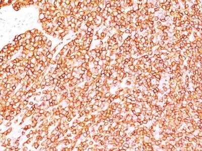 Immunohistochemistry-Paraffin: CD45 Antibody (SPM570) - Azide and BSA Free [NBP2-34804]