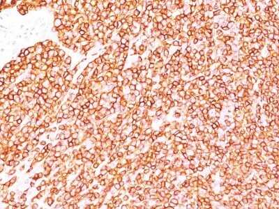 Immunohistochemistry-Paraffin: CD45 Antibody (SPM570) - IHC-Prediluted [NBP2-44854]