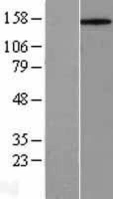 Western Blot: CD45 Overexpression Lysate [NBL1-14981]