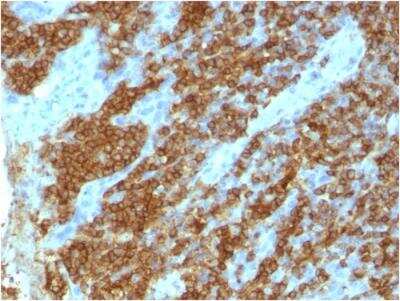 Immunohistochemistry-Paraffin: CD45RA Antibody (111-1C5) - IHC-Prediluted [NBP2-48452]