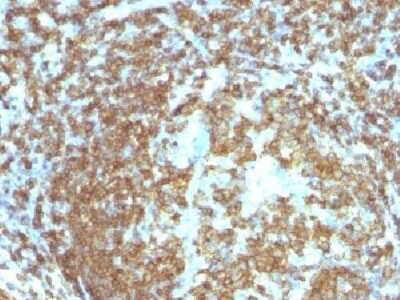 Immunohistochemistry-Paraffin: CD45RA Antibody (158-4D3) - IHC-Prediluted [NBP2-44851]