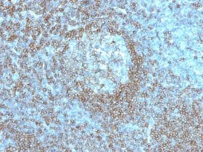 Immunohistochemistry-Paraffin: CD45RA Antibody (K4B5) - Azide and BSA Free [NBP3-08901]