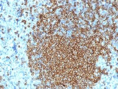 Immunohistochemistry-Paraffin: CD45RA Antibody (K4B5) [NBP3-07159]