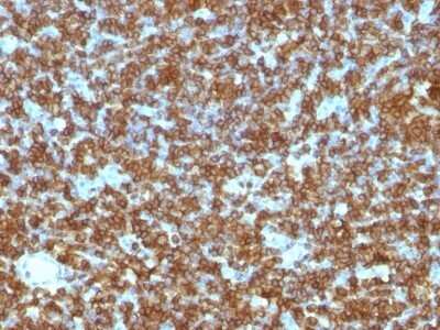 Immunohistochemistry-Paraffin: CD45RA Antibody (PTPRC/1131) - IHC-Prediluted [NBP2-48450]