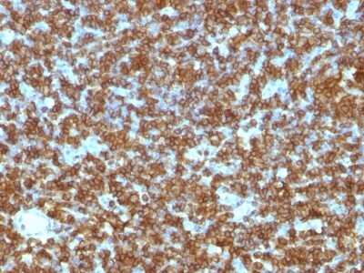 Immunohistochemistry-Paraffin: CD45RA Antibody (PTPRC/1131) [NBP2-44845]