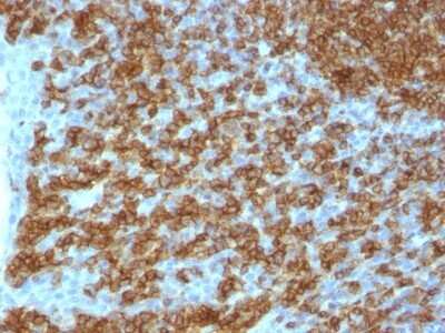 Immunohistochemistry-Paraffin: CD45RA Antibody (PTPRC/1148) - Azide and BSA Free [NBP2-54335]