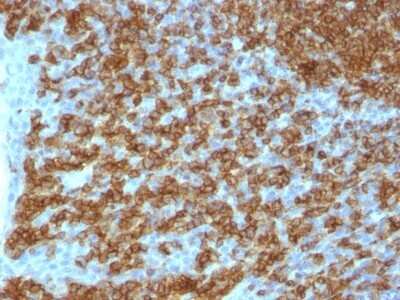 Immunohistochemistry-Paraffin: CD45RA Antibody (PTPRC/1148) [NBP2-44848]