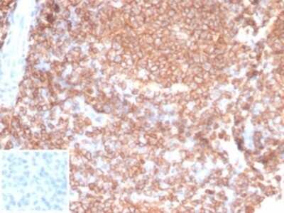 Immunohistochemistry-Paraffin: CD45RA Antibody (PTPRC/7019R) [NBP3-13758]