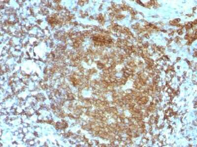 Immunohistochemistry-Paraffin: CD45RA Antibody (PTPRC/818) [NBP2-44844]
