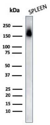 Western Blot: CD45RA Antibody (PTPRC/818) [NBP2-44844]