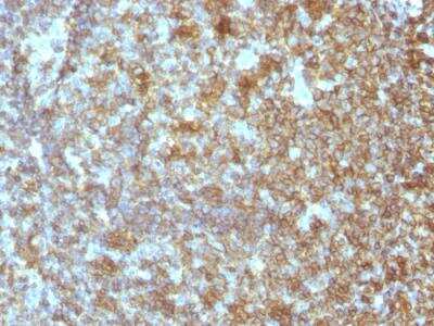 Immunohistochemistry-Paraffin: CD45RA Antibody (SPM504) - IHC-Prediluted [NBP2-48453]