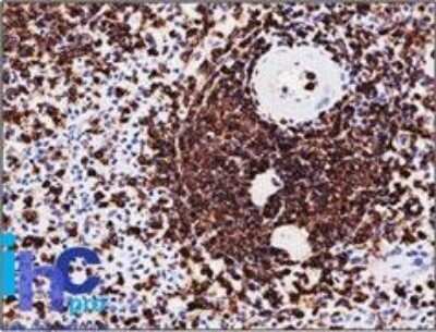 Immunohistochemistry-Paraffin: CD45RA Antibody (SPM568) - Azide and BSA Free [NBP2-34802]