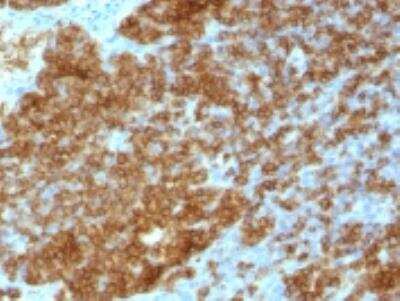 Immunohistochemistry-Paraffin: CD45RA Antibody (SPM568) [NBP2-32936]