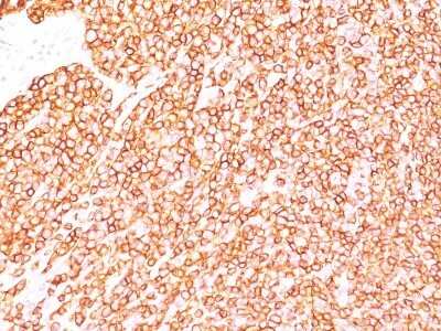 Immunohistochemistry-Paraffin: CD45RB Antibody (BRA-11 (same as BRA-11G)) - Azide and BSA Free [NBP2-34564]