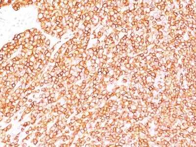 Immunohistochemistry-Paraffin: CD45RB Antibody (BRA-11 (same as BRA-11G)) - IHC-Prediluted [NBP2-44859]