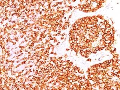 Immunohistochemistry-Paraffin: CD45RB Antibody (DF-B1) [NBP2-44843]