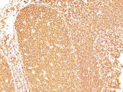 Immunohistochemistry-Paraffin: CD45RB Antibody (PD7/26) - IHC-Prediluted [NBP2-44855]