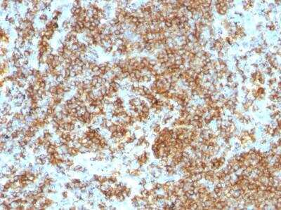 Immunohistochemistry-Paraffin: CD45RB Antibody (PTPRC/1132) - IHC-Prediluted [NBP2-48459]