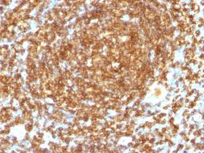 Immunohistochemistry-Paraffin: CD45RB Antibody (PTPRC/1132) [NBP2-44846]