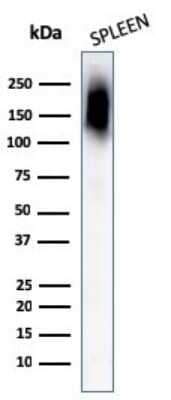 Western Blot: CD45RB Antibody (PTPRC/1132) [NBP2-44846]