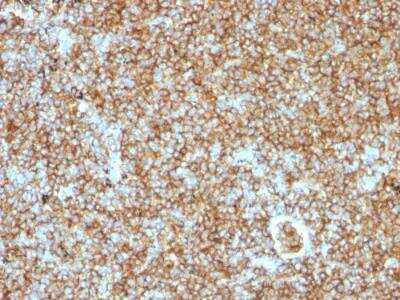 Immunohistochemistry-Paraffin: CD45RB Antibody (PTPRC/1147) - IHC-Prediluted [NBP2-48463]
