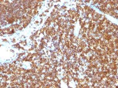 Immunohistochemistry-Paraffin: CD45RB Antibody (PTPRC/1147) - IHC-Prediluted [NBP2-48463]