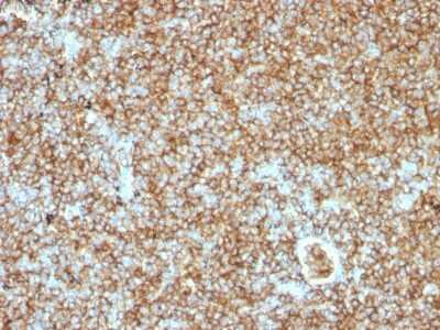 Immunohistochemistry-Paraffin: CD45RB Antibody (PTPRC/1147) [NBP2-44847]