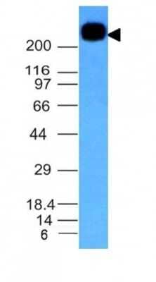 Western Blot: CD45RB Antibody (PTPRC/1147) [NBP2-44847]