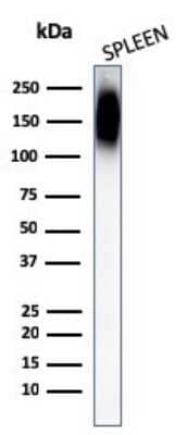 Western Blot: CD45RB Antibody (PTPRC/1147) [NBP2-44847]