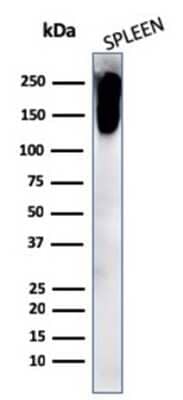 Western Blot: CD45RB Antibody (PTPRC/2877R)Azide and BSA Free [NBP3-08924]