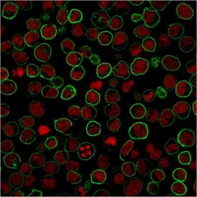 Immunocytochemistry/ Immunofluorescence: CD45RB Antibody (PTPRC/2877R) [NBP3-07180]