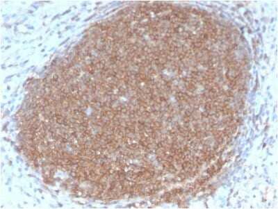 Immunohistochemistry-Paraffin: CD45RB Antibody (PTPRC/2877R) [NBP3-07180]
