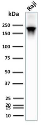 Western Blot: CD45RB Antibody (PTPRC/2877R) [NBP3-07180]