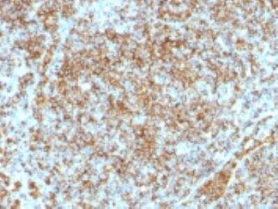 Immunohistochemistry-Paraffin: CD45RB Antibody (SPM569) [NBP2-32938]