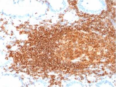 Immunohistochemistry-Paraffin: CD45RB Antibody (rPTPRC/1132) [NBP3-07166]