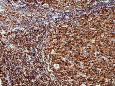 Immunohistochemistry-Paraffin: CD45RC Antibody (RM291) [NBP2-61512]