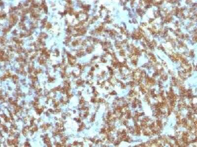 Immunohistochemistry-Paraffin: CD45RO Antibody (SPM125) - Azide and BSA Free [NBP2-34735]