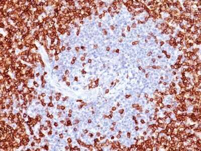 Immunohistochemistry-Paraffin: CD45RO Antibody (T200/797) - Azide and BSA Free [NBP2-54315]