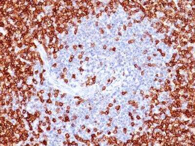 Immunohistochemistry-Paraffin: CD45RO Antibody (T200/797) - IHC-Prediluted [NBP2-48465]