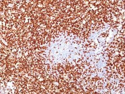 Immunohistochemistry-Paraffin: CD45RO Antibody (UCHL-1 + T200/797) [NBP2-44849]