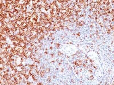 Immunohistochemistry-Paraffin: CD45RO Antibody (UCHL-1) - Azide and BSA Free [NBP2-33104]