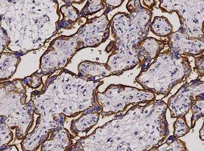 Immunohistochemistry-Paraffin: CD46 Antibody (001) [NBP2-90080]
