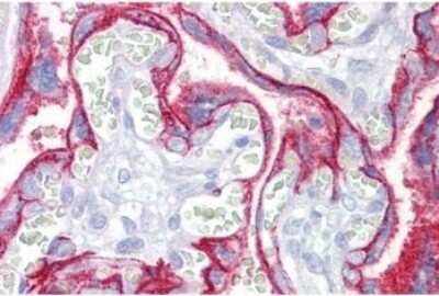 Immunohistochemistry-Paraffin: CD46 Antibody (3F1) - Azide and BSA Free [NBP1-52854]