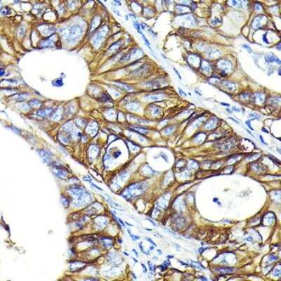 Immunohistochemistry-Paraffin: CD46 Antibody (6D2A4) [NBP3-15618]