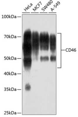 Western Blot: CD46 Antibody (6D2A4) [NBP3-15618]