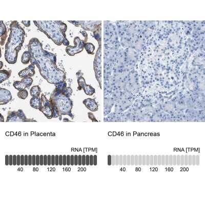 Immunohistochemistry-Paraffin: CD46 Antibody [NBP1-82790]