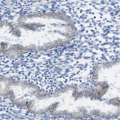 Immunohistochemistry-Paraffin: CD46 Antibody [NBP1-82790]
